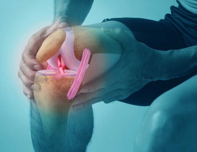 ACL Injury