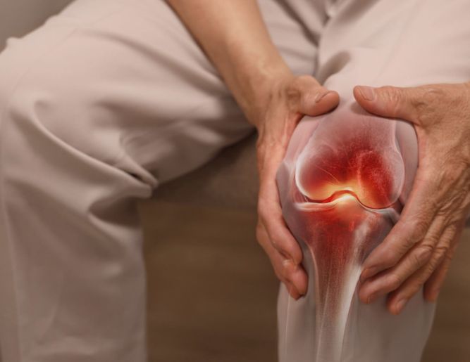 Arthritis (Osteoarthritis / Rheumatoid) Treatment