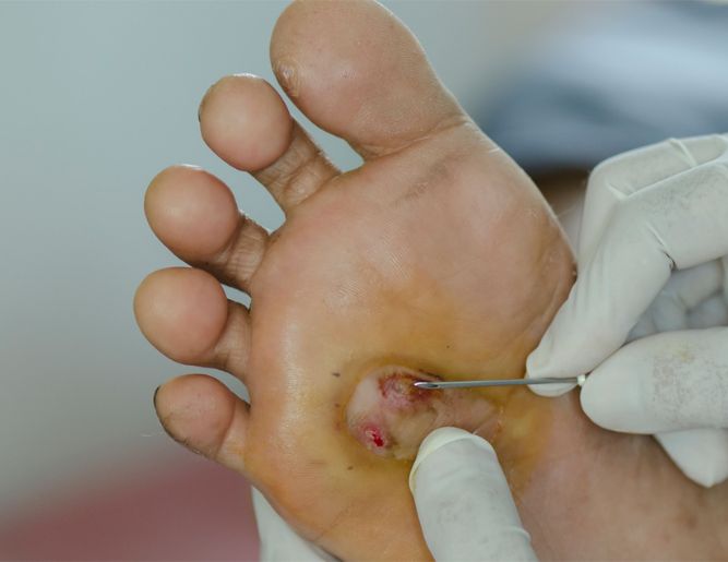 Diabetic Foot Care