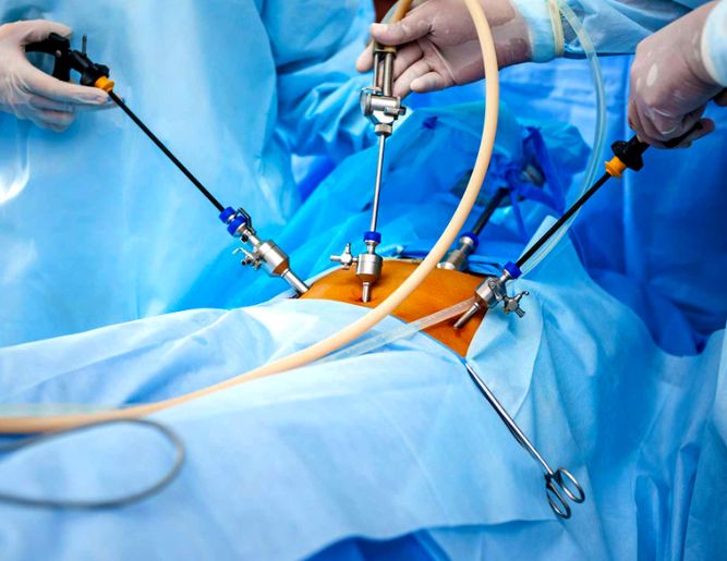 Endoscopic Urology Procedures