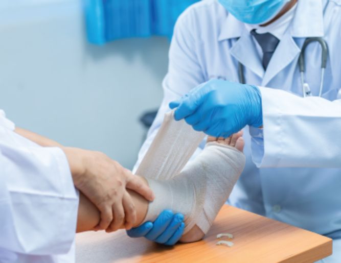 Fracture Management