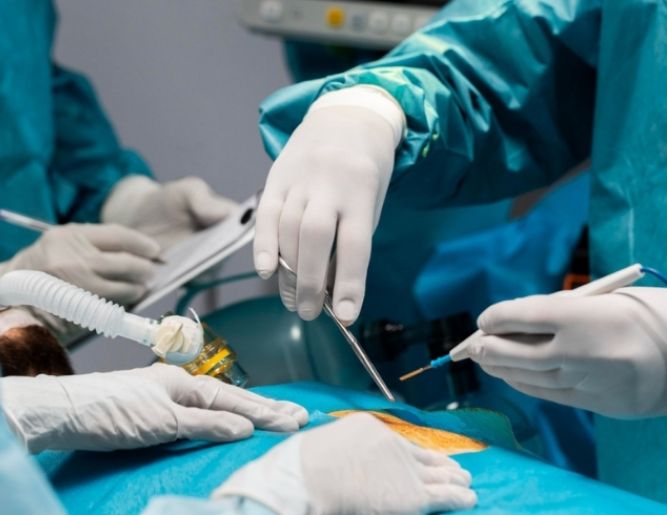 Hydrocele Surgery