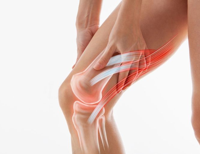 Joint Dislocation Treatment
